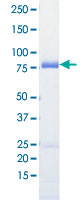 Loading 1 μg protein in SDS-PAGE